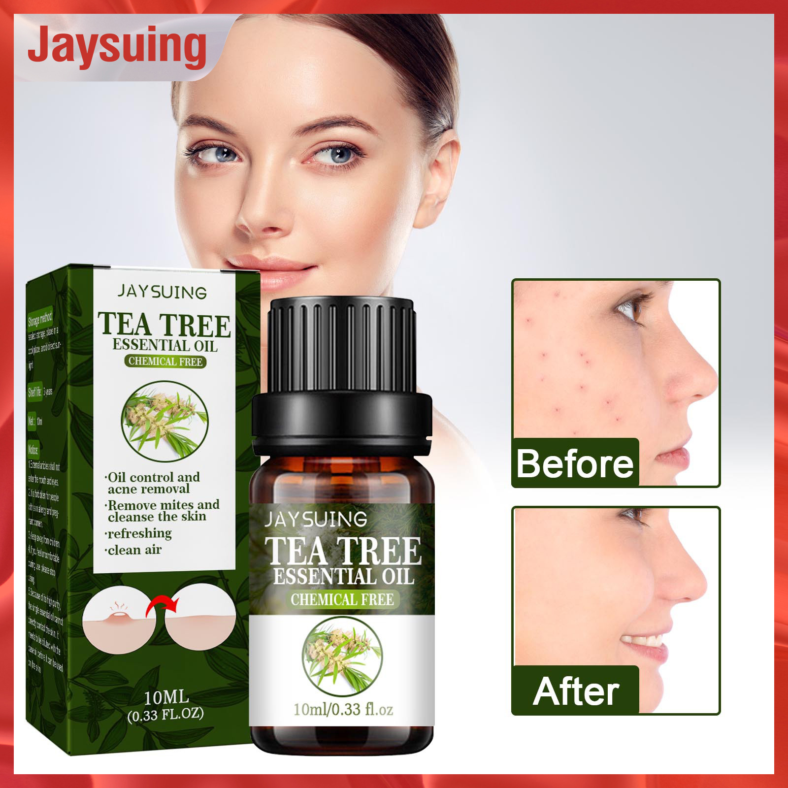 Jaysuing Tea Tee Essential Oil for Acne Scar Removal Cystic Treatment