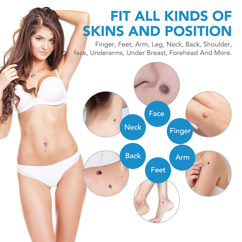 %E3%80%90Value%20Bundle%E3%80%91%202%20IN%201%20Auto%20Skin%20Tag%20Remover%20Kit%20Skin%20Tag%20Removal%20Device%20Mole%20Stain%20Wart%20Remover%20Care%20Skincare%20Pen%20Removal%20Set%20-%20Image%206