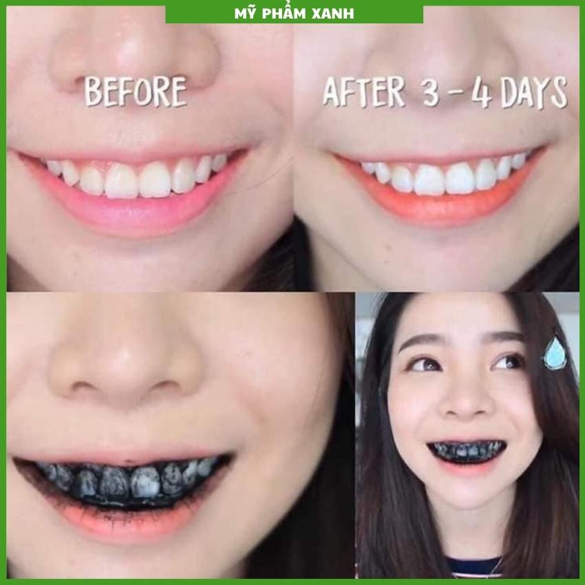 Bột trắng răng than tre cho hàm răng trắng sáng 70gr