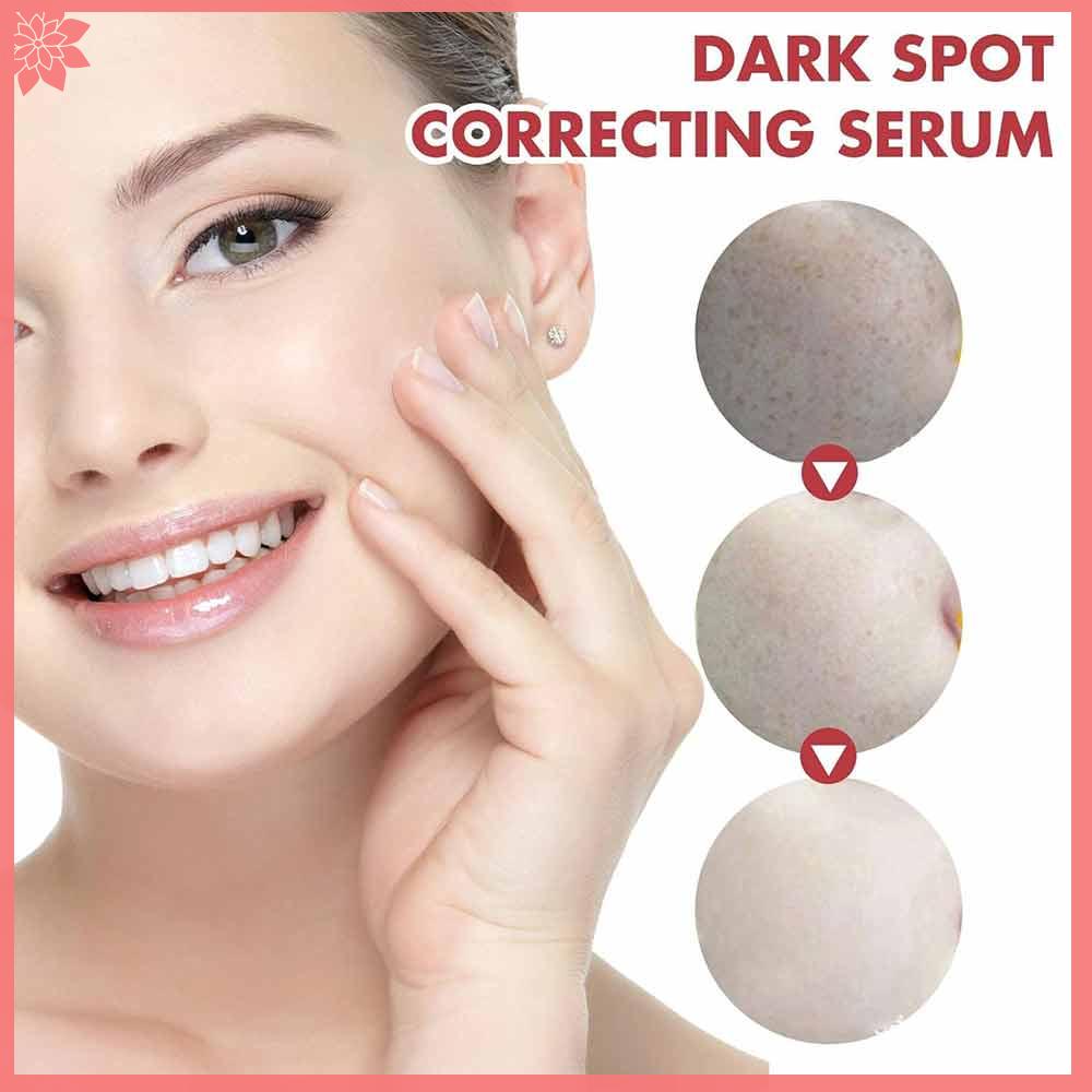 Dark Spot Correction Serum 30ml Face Skin Care Tools