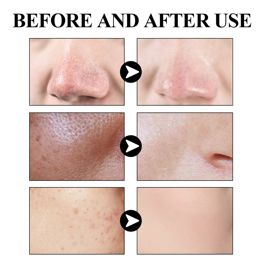 B-fdikou eelhoe thu nhỏ lỗ chân lông mặt nạ đen 50ml