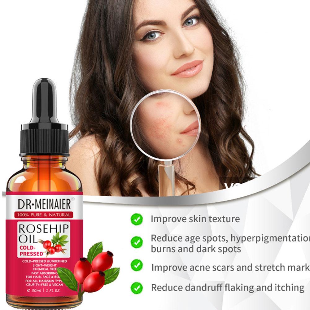 Rosehip%20Essential%20Oil%20Natural%20Oil%20Face%20Anti%20Aging%20Wrinkle%20Facial%20Moisturizer%20Serum%20Scar%20Skin%20Massage%20Care%20Gua%20Treatment%20Sha%20G3H4%20-%20Image%202