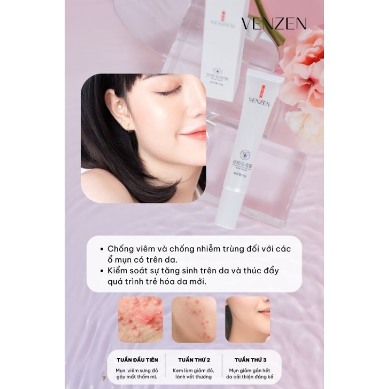 Tuýp kem bôi mụn của bioaqua