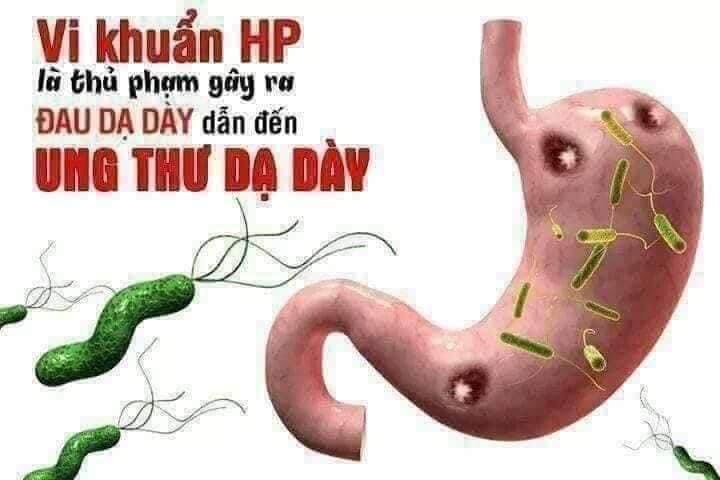 DẠ DÀY HẰNG THU