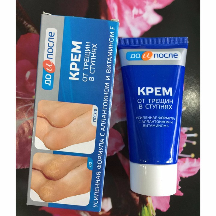 [FreeshipMAX] Kem mờ nứt gót chân Kpem dưỡng da chân