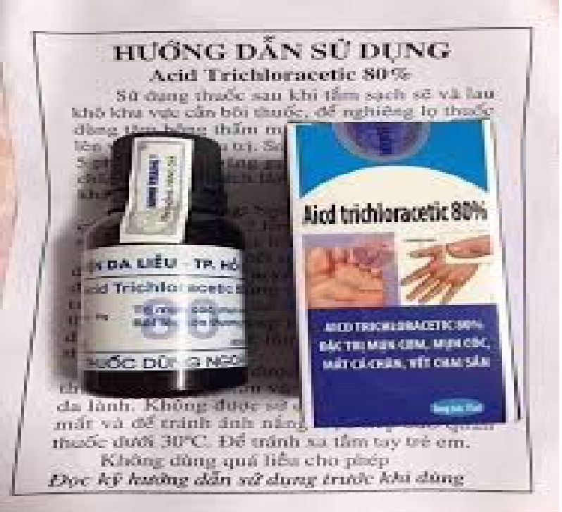 Mụn Cơm, Mụn Cóc, Mắt Cá Chân, Vết Chai Sần