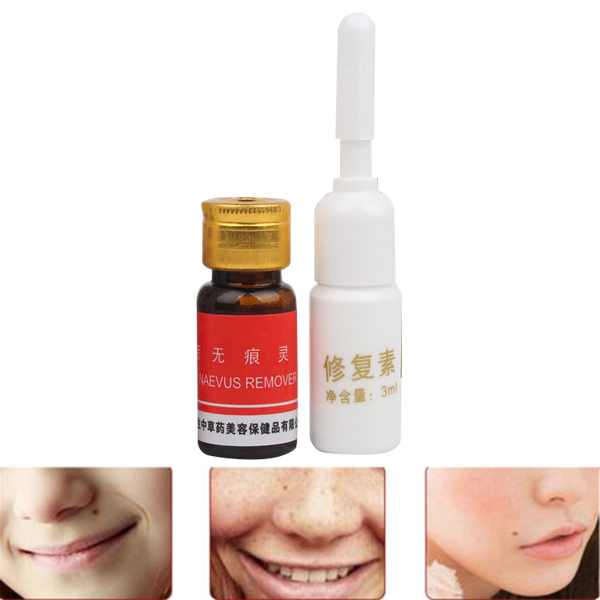 Mole Remover Set Skin Care Tags Warts Removal Repair Solution Kit