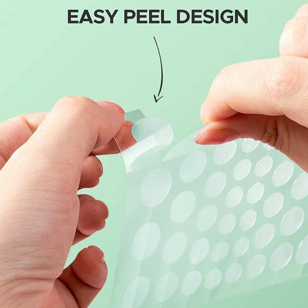 30PCS%20Acne%20Pimple%20Patch%20Face%20Mask%20Peeling%20Acne%20Treatments%20Pimple%20Remover%20Tool%20Blemish%20Spot%20Acne%20Cream%20Skin%20Care%20Night%20Use%20-%20Image%206