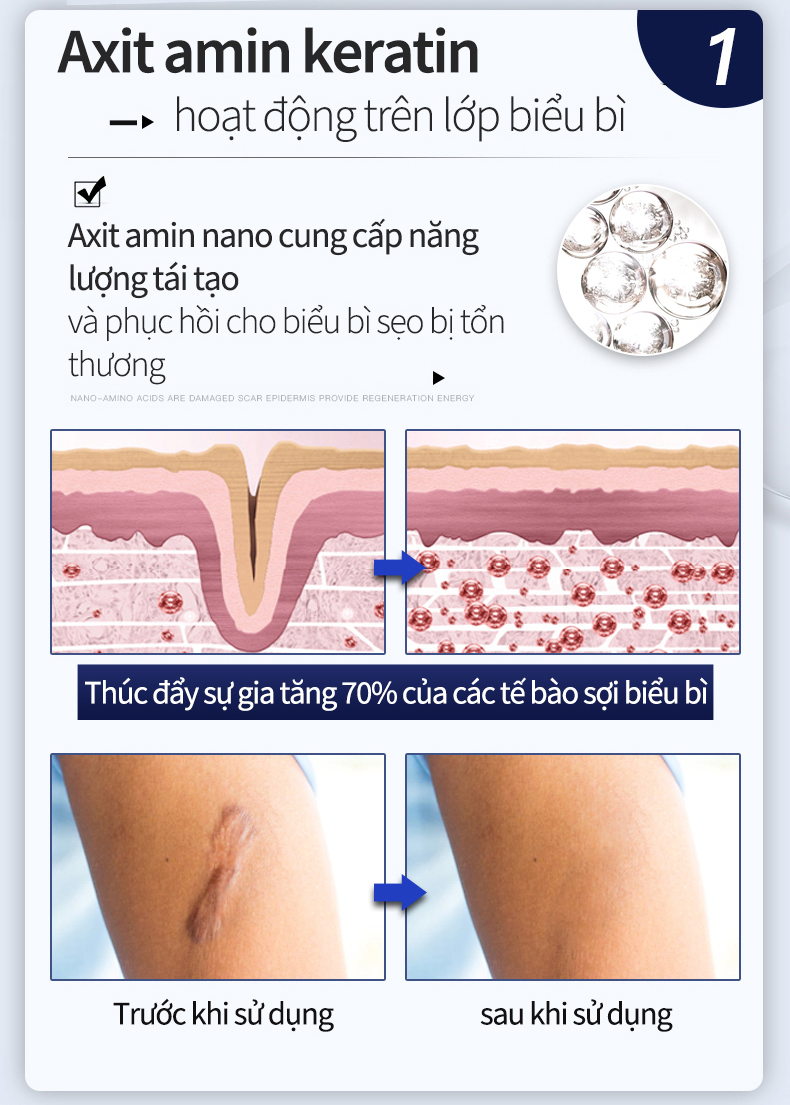 Kem loại bỏ sẹo Tái tạo tế bào da sâu Gel phục hồi vết sẹo Ngăn ngừa muỗi đốt 50g...