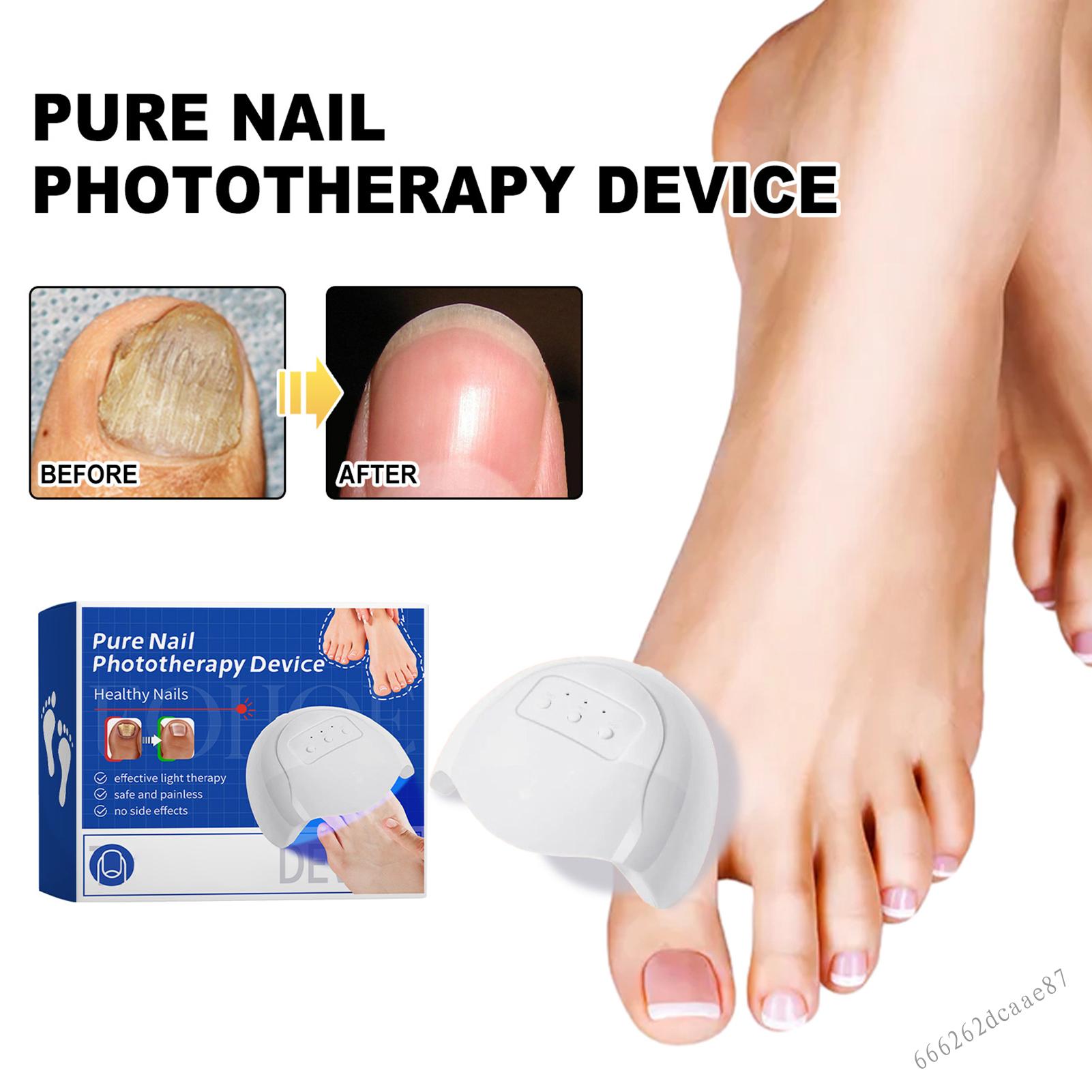 Nail Fungus Cleaning Laser Device Effective Rechargeable Nail Fungus Remover for Toenail