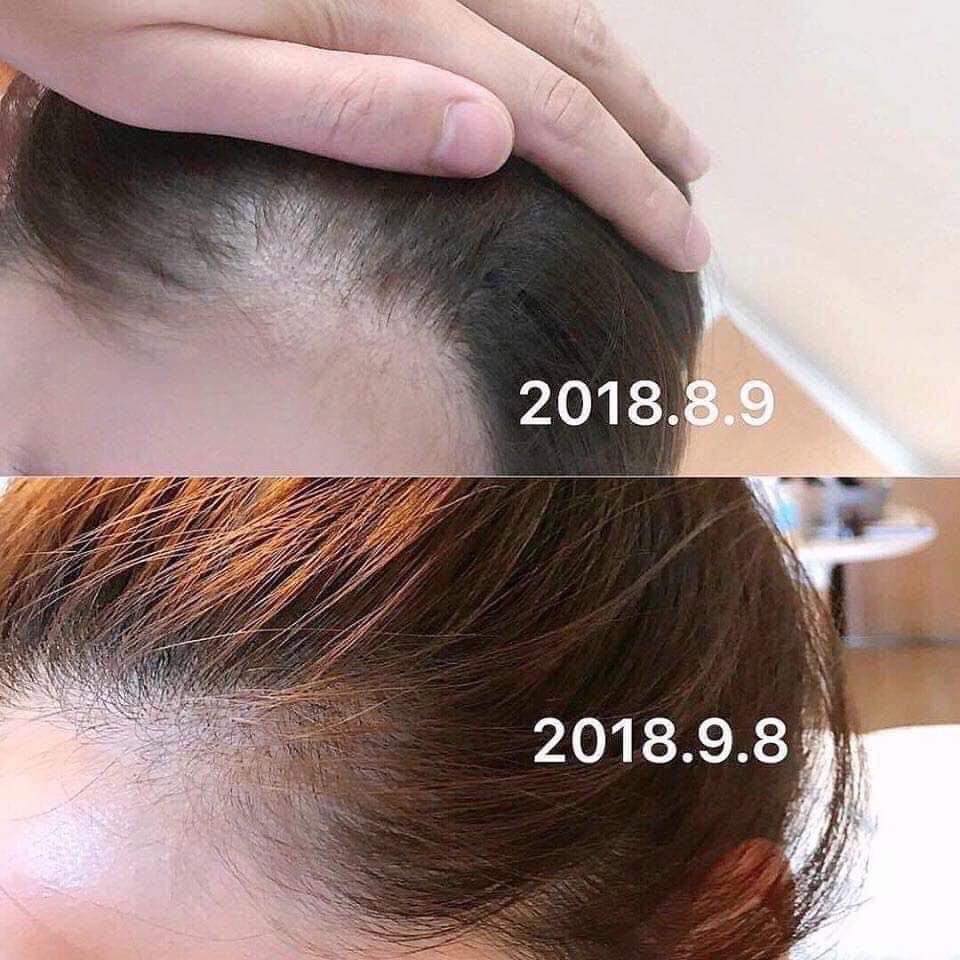 [ SIÊU HOT ] Tinh Chất Thảo Dược Kích Mọc Tóc SATO Arovics 30ml NHẬT BẢN