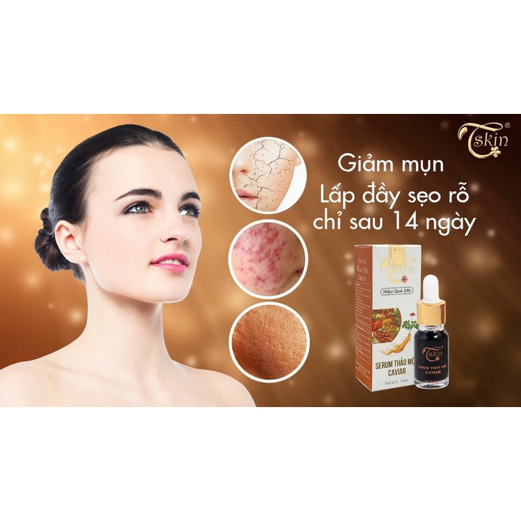 Serum dưỡng trắng da mờ thâm mụn căn bóng da Caviar 10ml