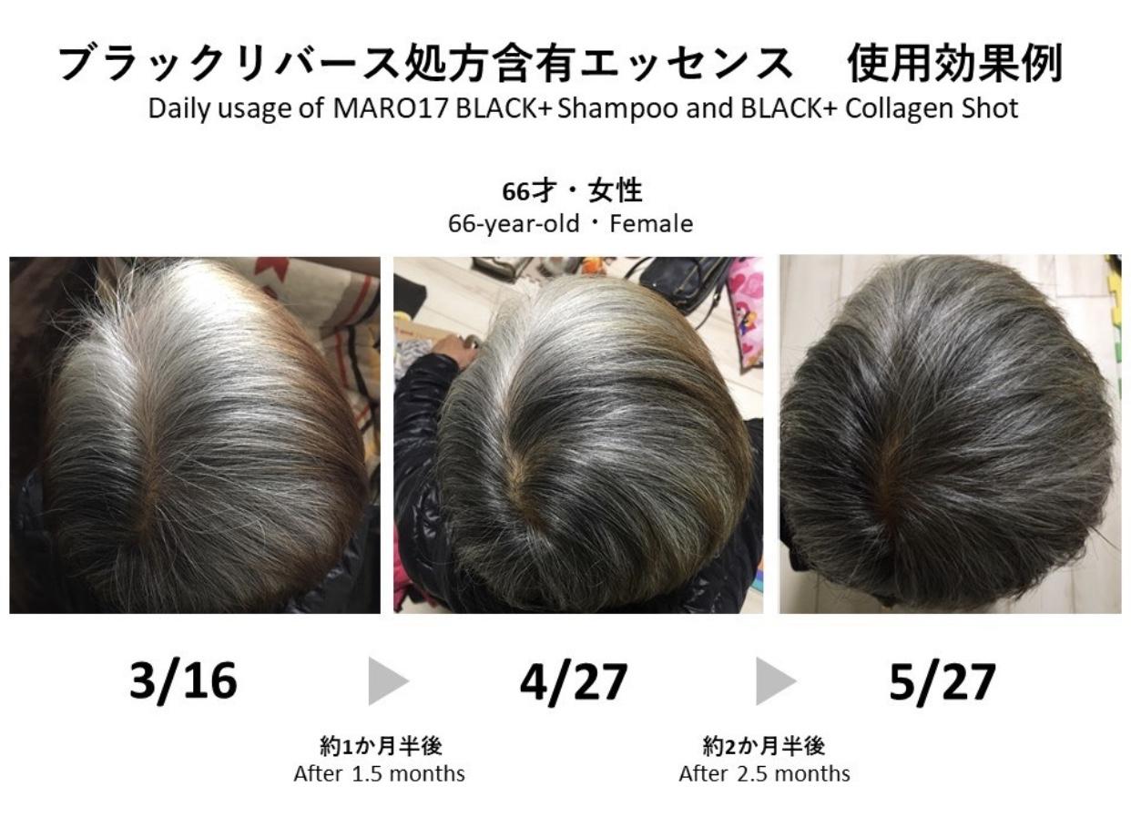 MARO 17 Black+ Collagen Shot 50ml (Promote Hair Growth, Prevent, Delay and  Reverse hair greying) + FOC Bath Sponge | Lazada Singapore