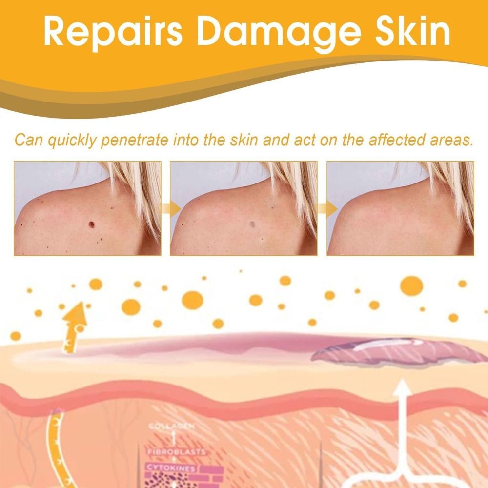 20ML%20Mole%20Skin%20Tag%20Recede%20Bee%20Venom%20Spray%20Painless%20Remover%20Dark%20Spot%20Warts%20Remover%20Effective%20Freckle%20Tag%20Recede%20Bee%20Venom%20for%20Face%20-%20Image%208