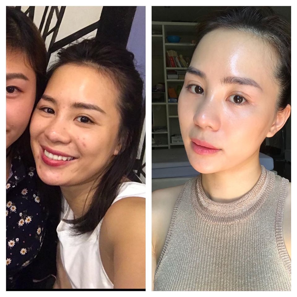 Serum sáng da mờ thâm sau mụn Vitamin C Balance Active Formula 30ml