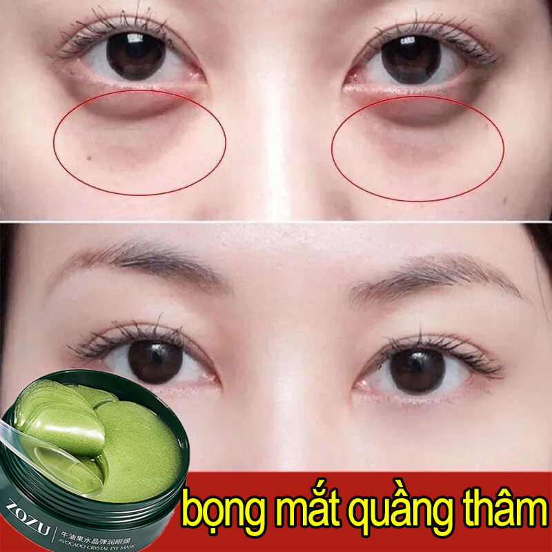 Mặt nạ mắt tinh chất bơ ZOZU mặt nạ mắt màu xanh,Mặt nạ mắt hộp 60 miếng Mặt Nạ Dưỡng Mắt Giảm Quầng Thâm Bọng Mắt Nhăn Mắt,Mặt nạ mắt thâm giữ ẩm…