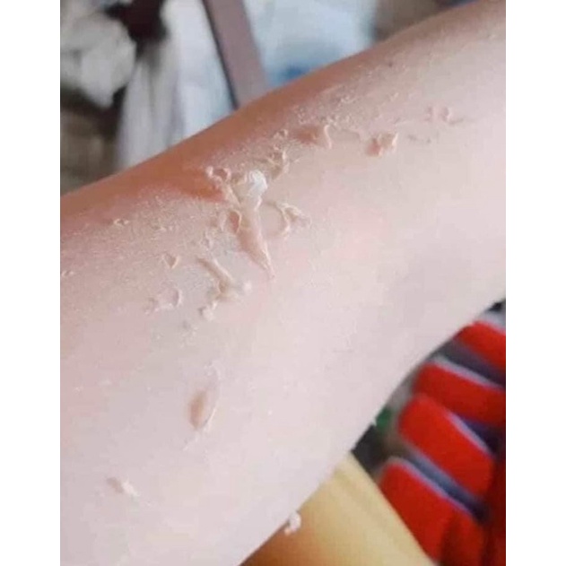 KEM BONG DA TÁI SINH BODY