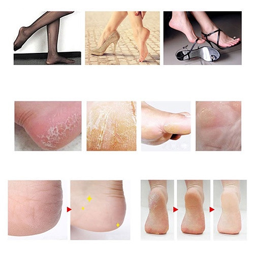 BỘ DỤNG CỤ CHÀ GÓT CHÂN, CHĂM SÓC MÓNG - SET 10 MÓN