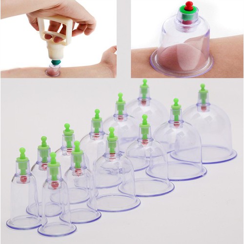 [HCM]BỘ DỤNG CỤ GIÁC HƠI -KHÔNG DÙNG LỬA - 12 Ống
