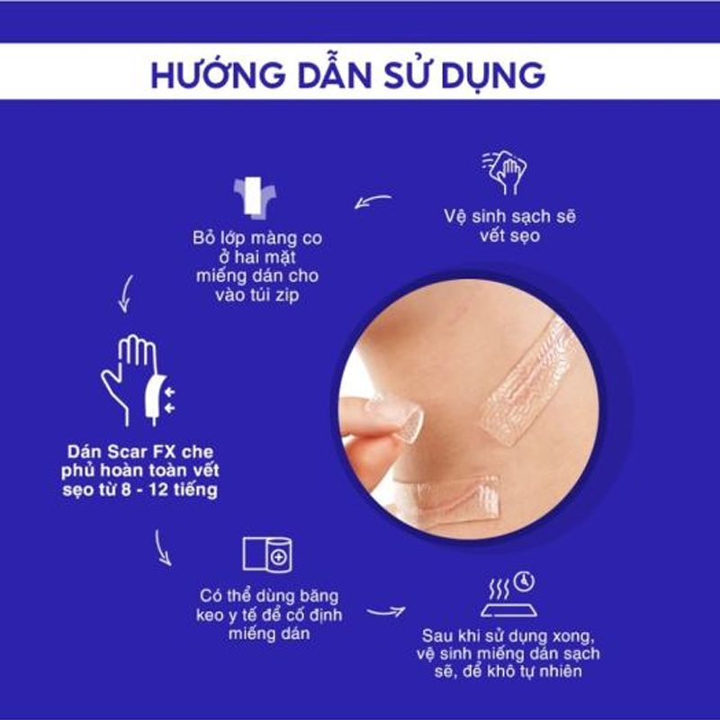 Miếng dán ép phẳng cải thiện sẹo lồi, phì đại Rejuvaskin Scar FX