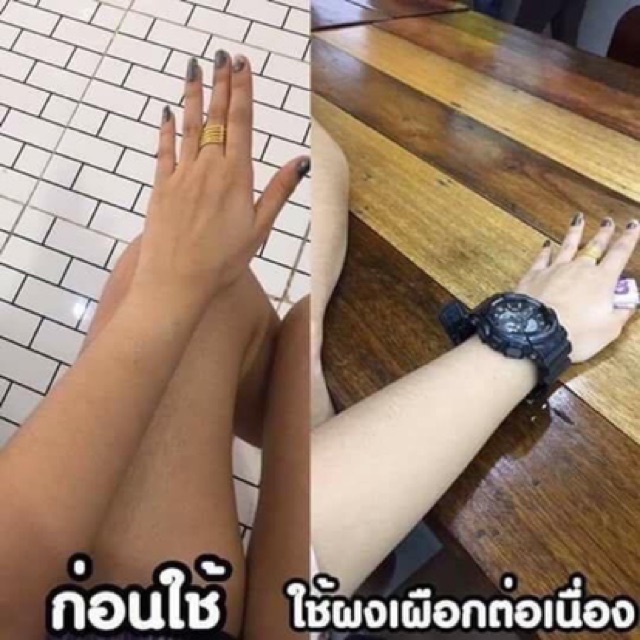 Bột Kích Trắng Kyra Alpha Arbutin  Thái Lan