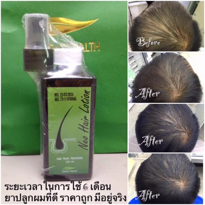 Neo Hair Lotion ( 2 ขวด) แบรนด์แท้ ส่งด่วน นีโอแฮร์โลชั่น neohair นีโอ