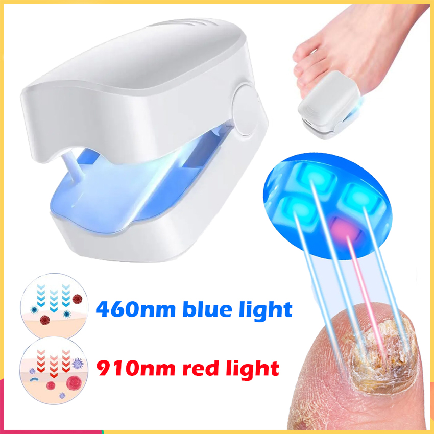 Professional Nail Fungus Cleaning Laser Device Repair Onychomycosis ...