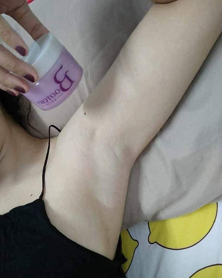 Tẩy thâm đen Bootchy White Snow Queen Extra Body Cream Thái Lan