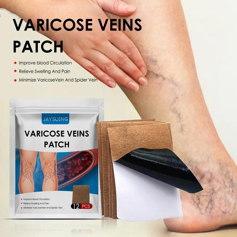 New%20model%20Varicose%20Veins%20Patch%20Relief%20Leg%20Vasculitis%20Spider%20Varicose%20Vein%20Patches%20Varicose%20Veins%20For%20Legs%20Improve%20Blood%20Foot%20Health%20Care%20-%20Image%206