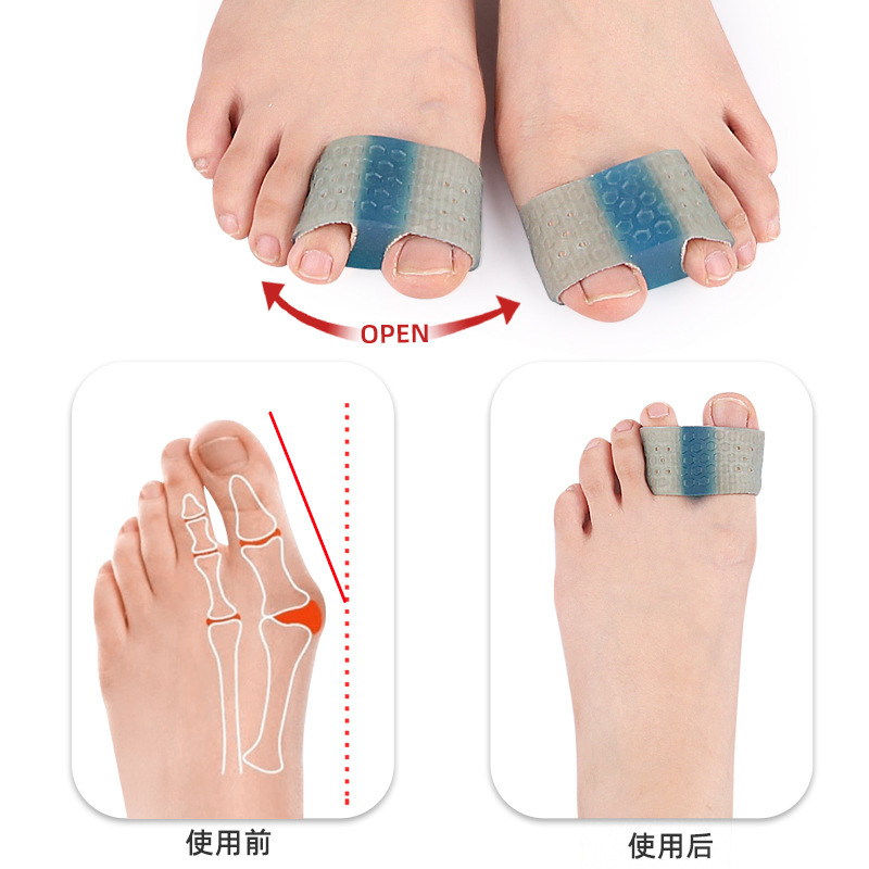 VTTO 1PCS Gel Toe Separators Bunion Corrector Pain Relief