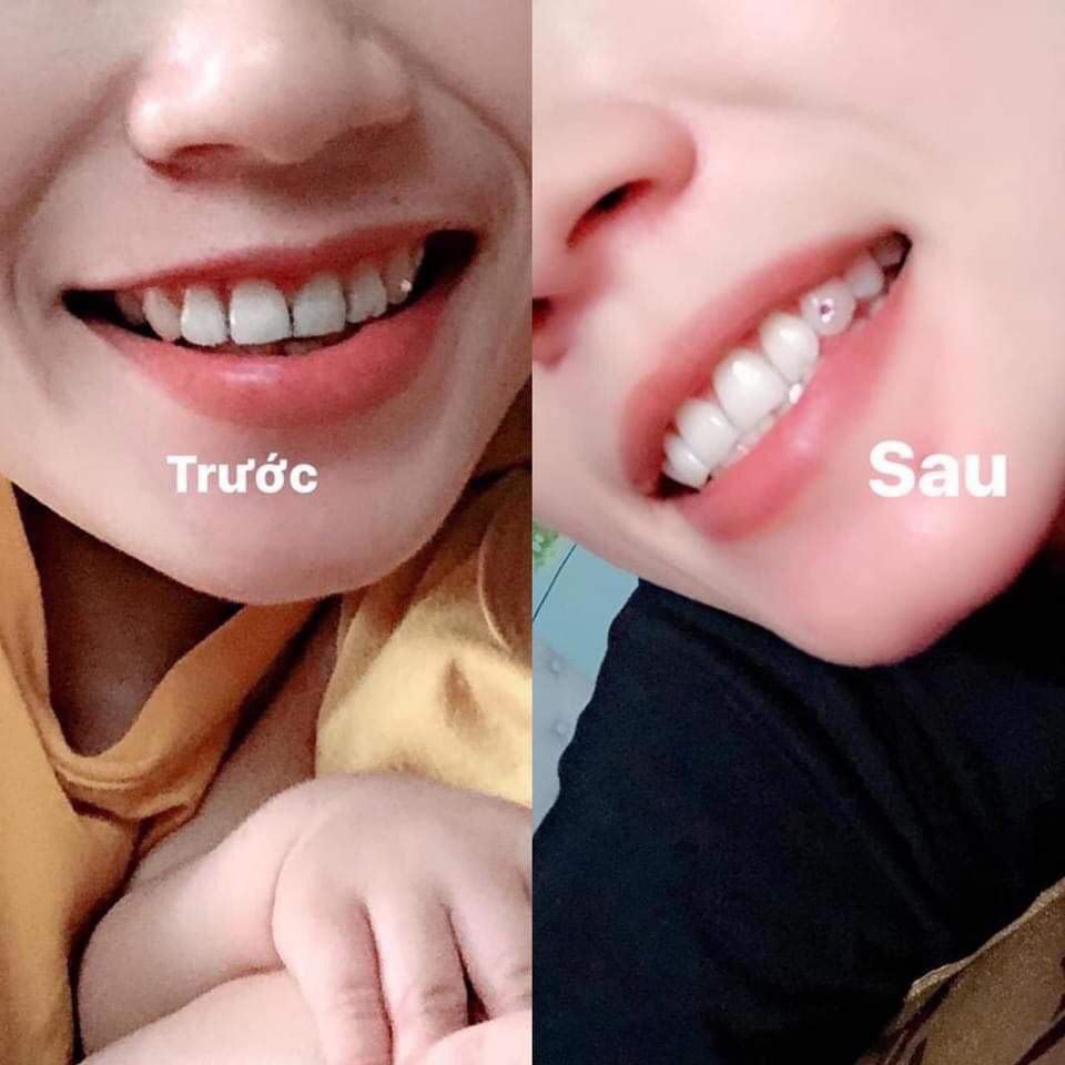 Bột trắng răng than tre cho hàm răng trắng sáng 70gr