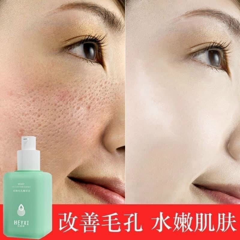 ( Chính hãng) Serum se khít lỗ chân lông Heyxi 60ml