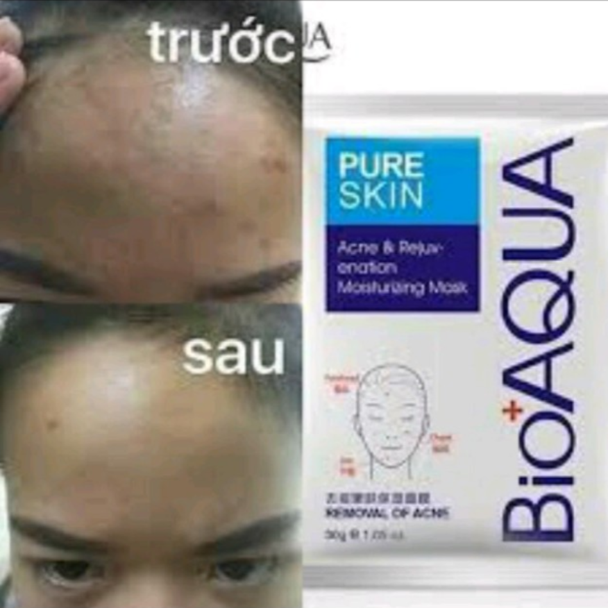 Mặt nạ mụn - Bioaqua Pure Skin