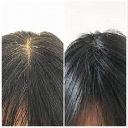 Dầu gội đen tóc Caotien - hộp 10 gói