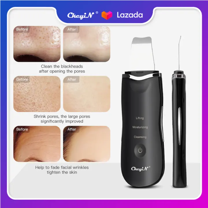 face exfoliator machine