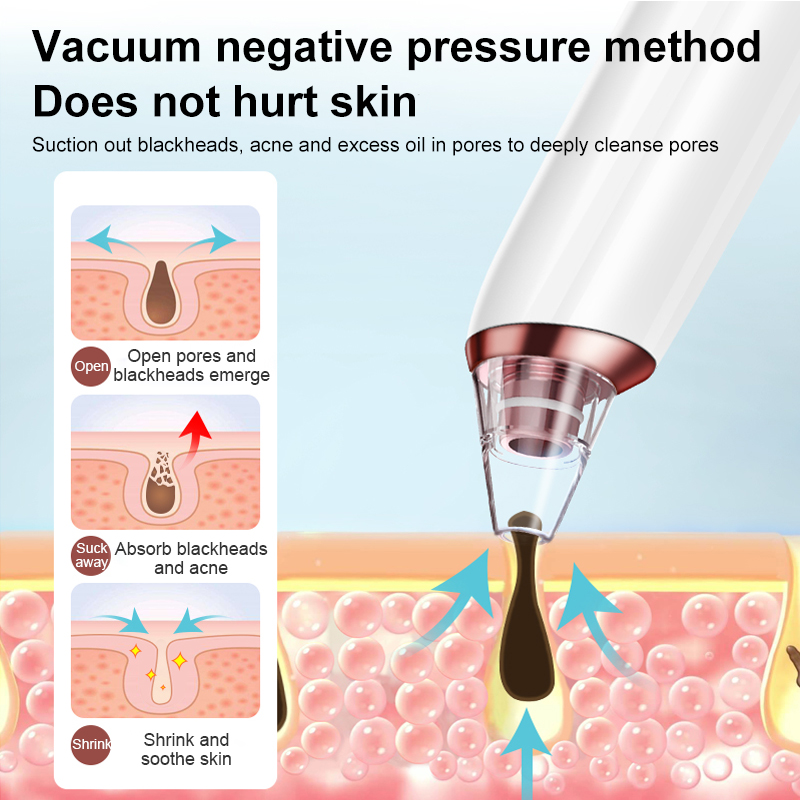 INSMART%20Electric%20Facial%20Blackhead%20Remover%20Vacuum%20Pore%20Cleaner%20Acne%20Cleanser%20Black%20Spots%20Removal%20Face%20Nose%20Deep%20Cleaning%20Tools%20-%20Image%2010