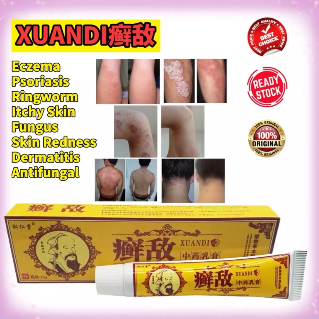 XUANDI Eczema Psoriasis Natural Chinese Herbal Medicine Cream 15g ...