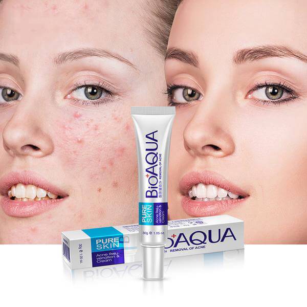 Bioaqua%20Mark%20Removal%20Gel%20Ointment%20Pure%20Anti%20Acne%20Cream%2030G%20-%20Image%203