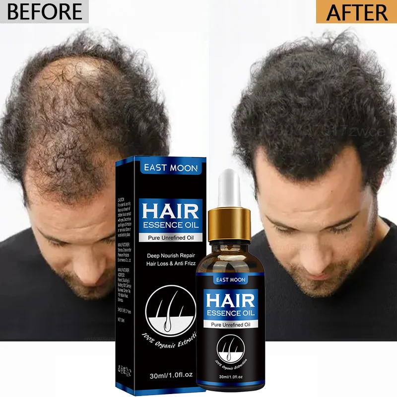 7-day Rapid Hair Growth Essential Oil Hair Regeneration Oil Anti-hair Loss Mild Repairs Hereditary Hair Essential Oil New. 