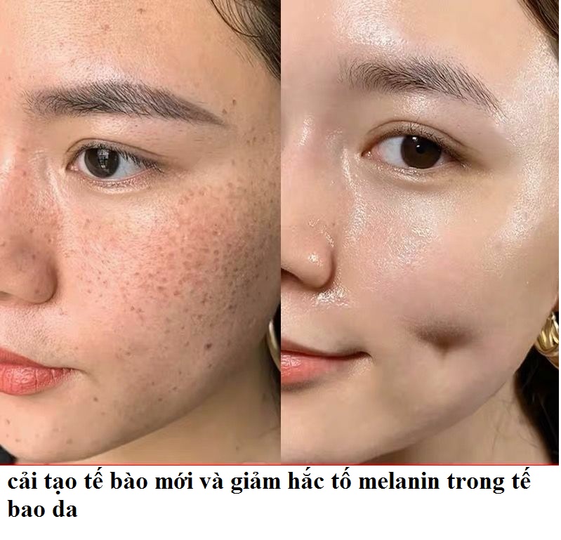 Serum Vitamine E ROUSHUN Thần Dược Của Da Tác Dụng Dưỡng ẩm Chống Lão Hóa Xóa Mờ Nám Tàn Nhang Giúp Da Trẻ Đẹp Trắng Sáng