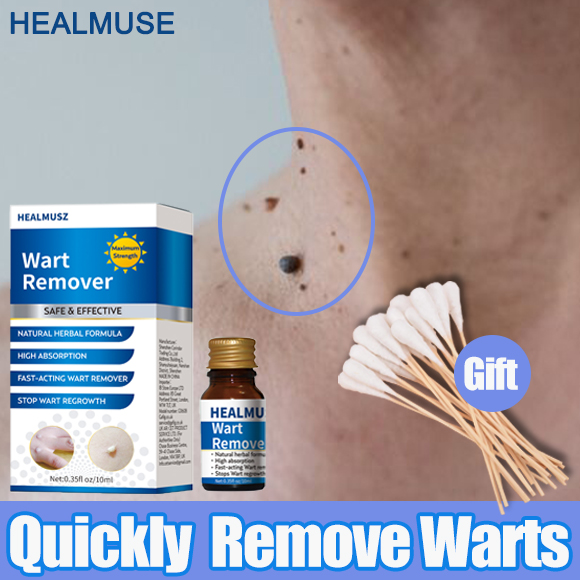 【eelhoe】warts Removal Ointment Warts Remover Original Cream Effectively Remover Skin Tags Mole