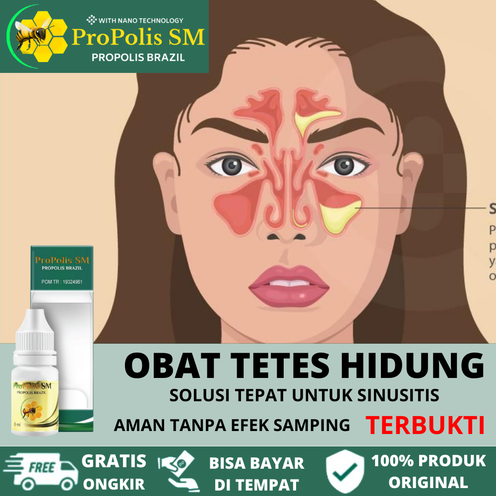 Obat Sinusitis Hidung, Sinusitis Kronis, Sinusitis Akut, Obat Pereda ...