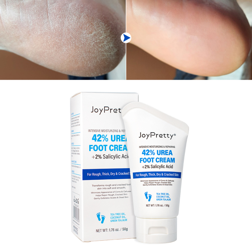 Joypretty Exfoliator Foot Cream Dead Skin Remover Heel Treatment