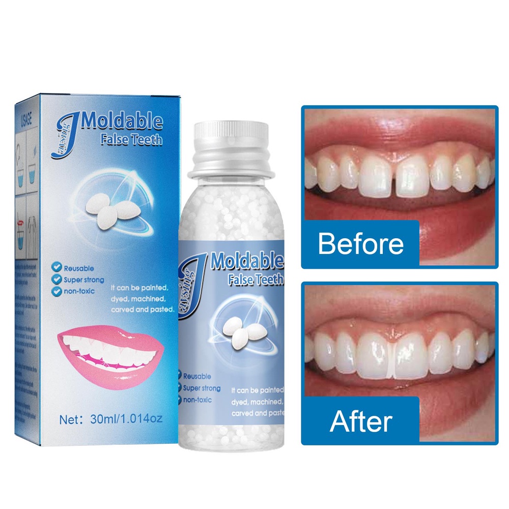 30ML Temporary Tooth Repair Kit Filling Teeth Gaps Moldable False