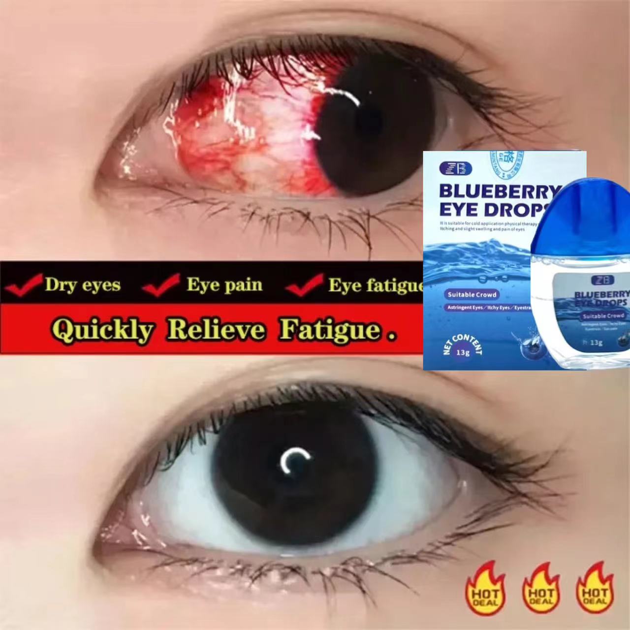 Obat tetes mata Tetes Mata Herbal Tetes Mata Alami eye drop Mengandung