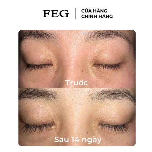 Serum Dưỡng Mi FEG EyeLash Enhancer 3ml