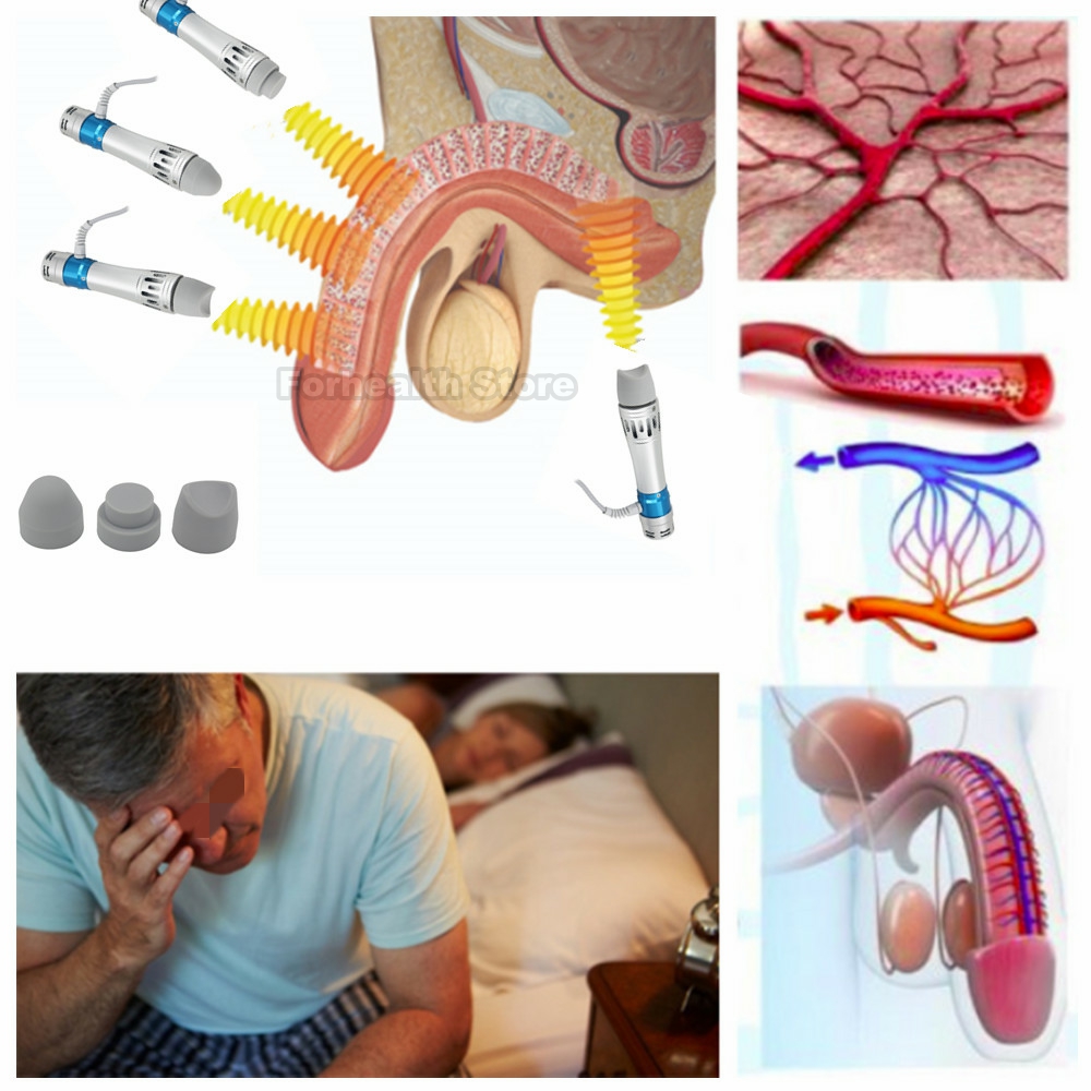 Shockwave Therapy Machine Accessory ED Silicone Massage Head Treatment Erectile Dysfunction For Shock Wave Therapy 2021 New. 