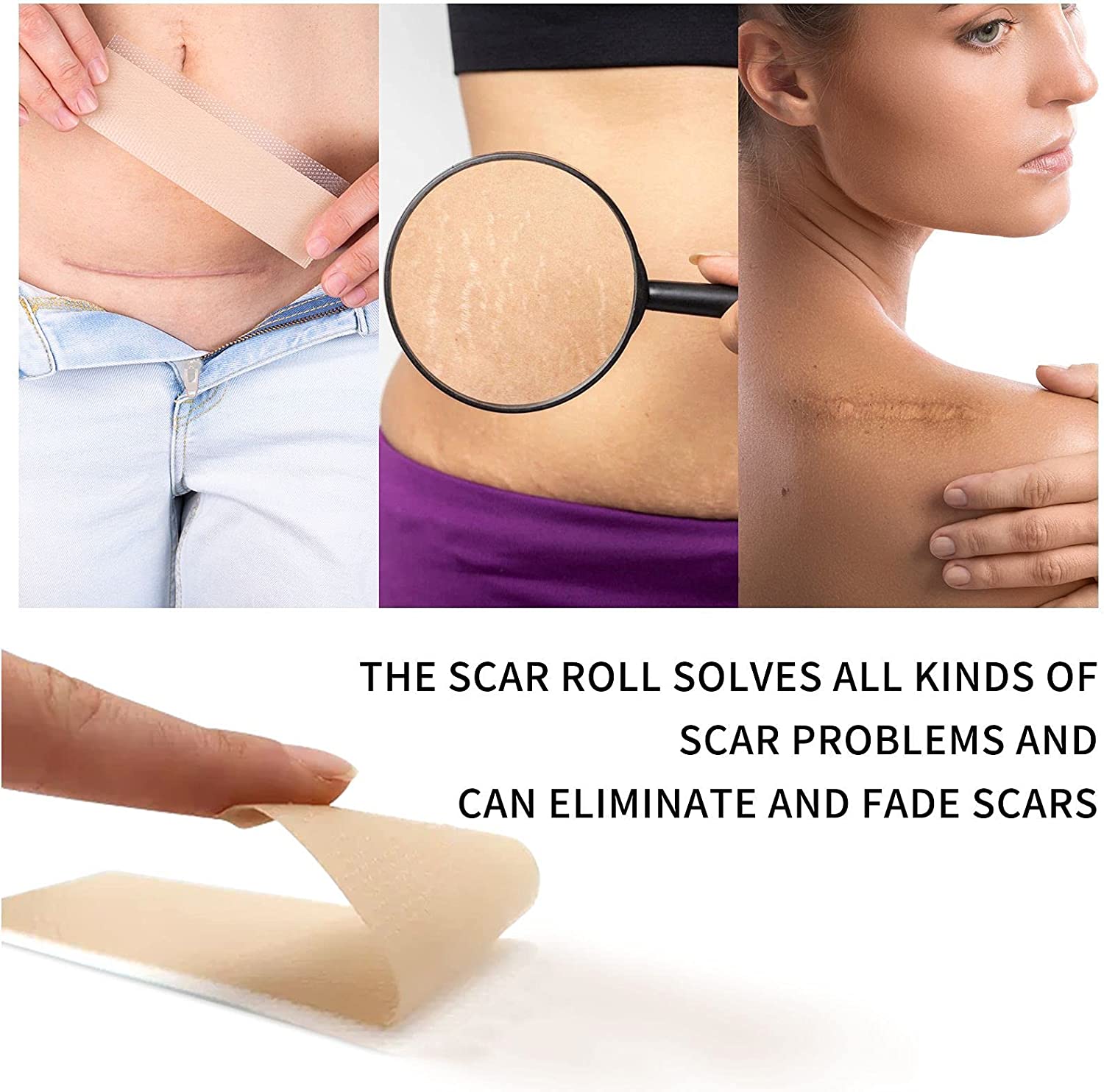 New%20model%201.5M/3M%20Scar%20Removal%20Patch%20Surgery%20Self-Adhesive%20Silicone%20Gel%20Tape%20Remove%20Scar%20Patch%20Sticker%20Acne%20Trauma%20Burn%20Scar%20Skin%20Care%20-%20Image%2010