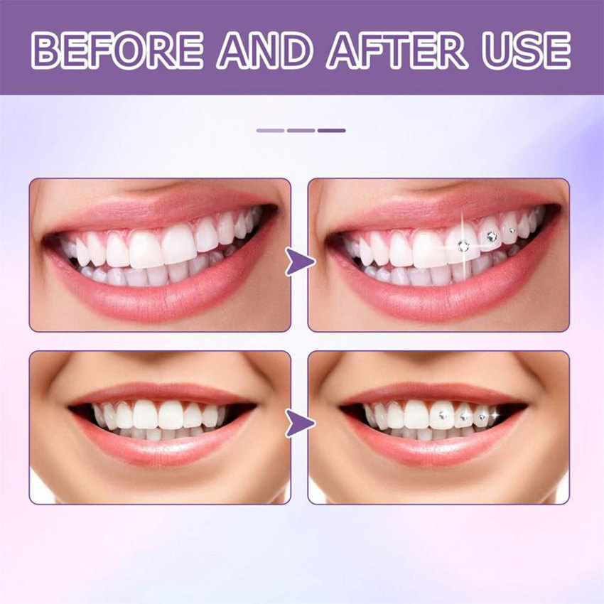 Tooth Gem Glue Dental Self-adhesive Gluel For Tooth Gems Diamond Kit Glue  Teeth Crystal Jewelry Tooth Orthodontic Adhesive Gel