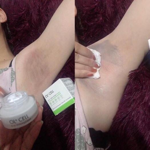 KEM TRỊ THÂM NÁCH, THÂM MÔI, THÂM NHŨ HOA HÀN QUỐC - Ol+Cell